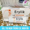 Erylik Gel Acne Treatment Treating Severe Acne