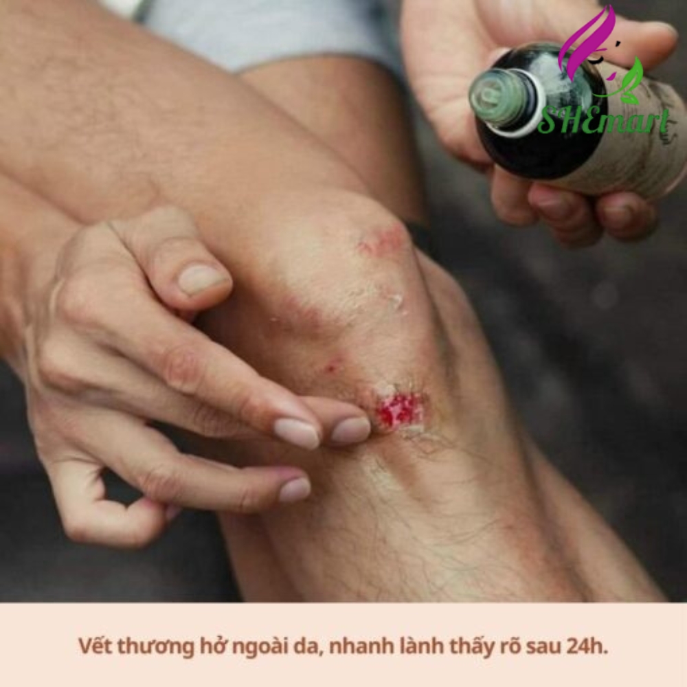 NOOM Cold-Pressed Tamanu Oil – A Natural Solution for Skin and Body Care