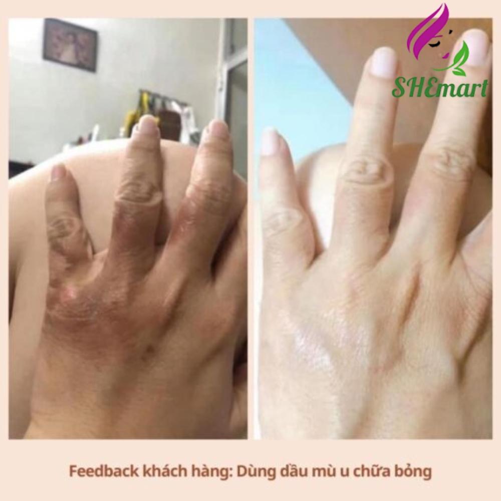 NOOM Cold-Pressed Tamanu Oil – A Natural Solution for Skin and Body Care