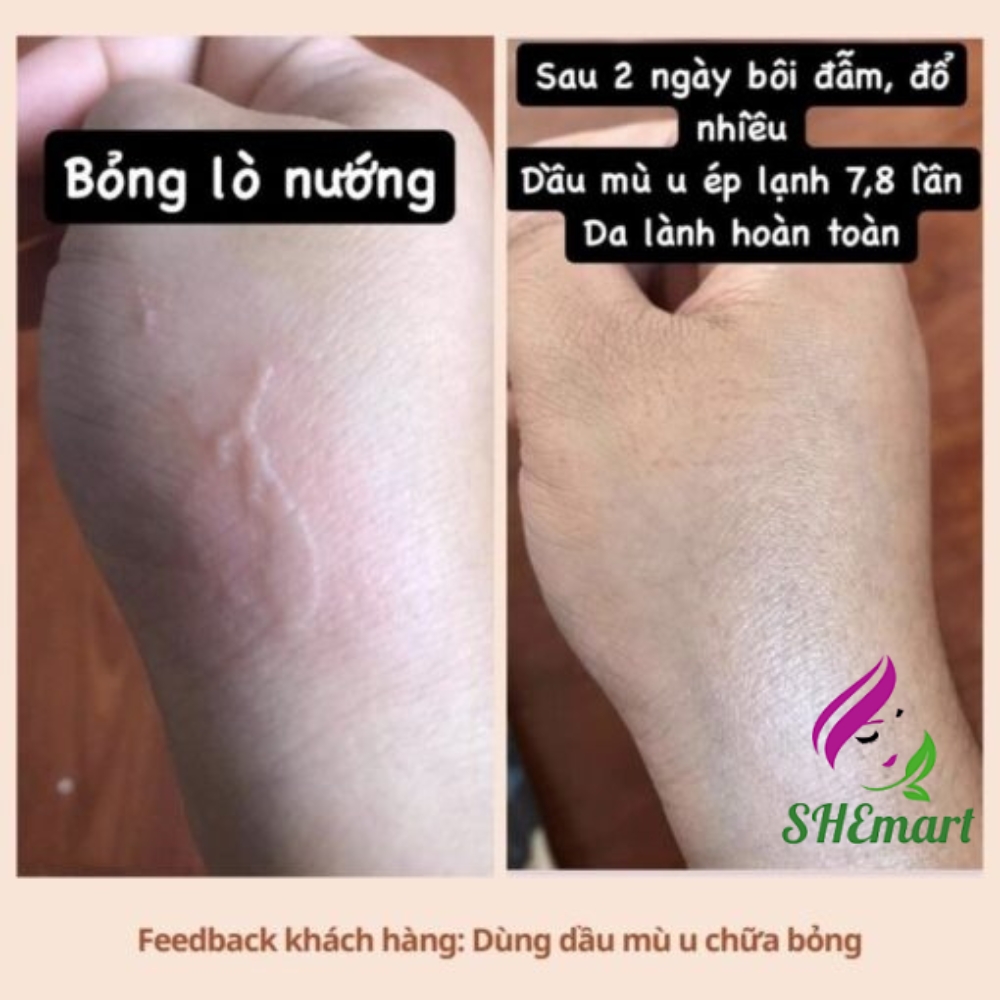 NOOM Cold-Pressed Tamanu Oil – A Natural Solution for Skin and Body Care