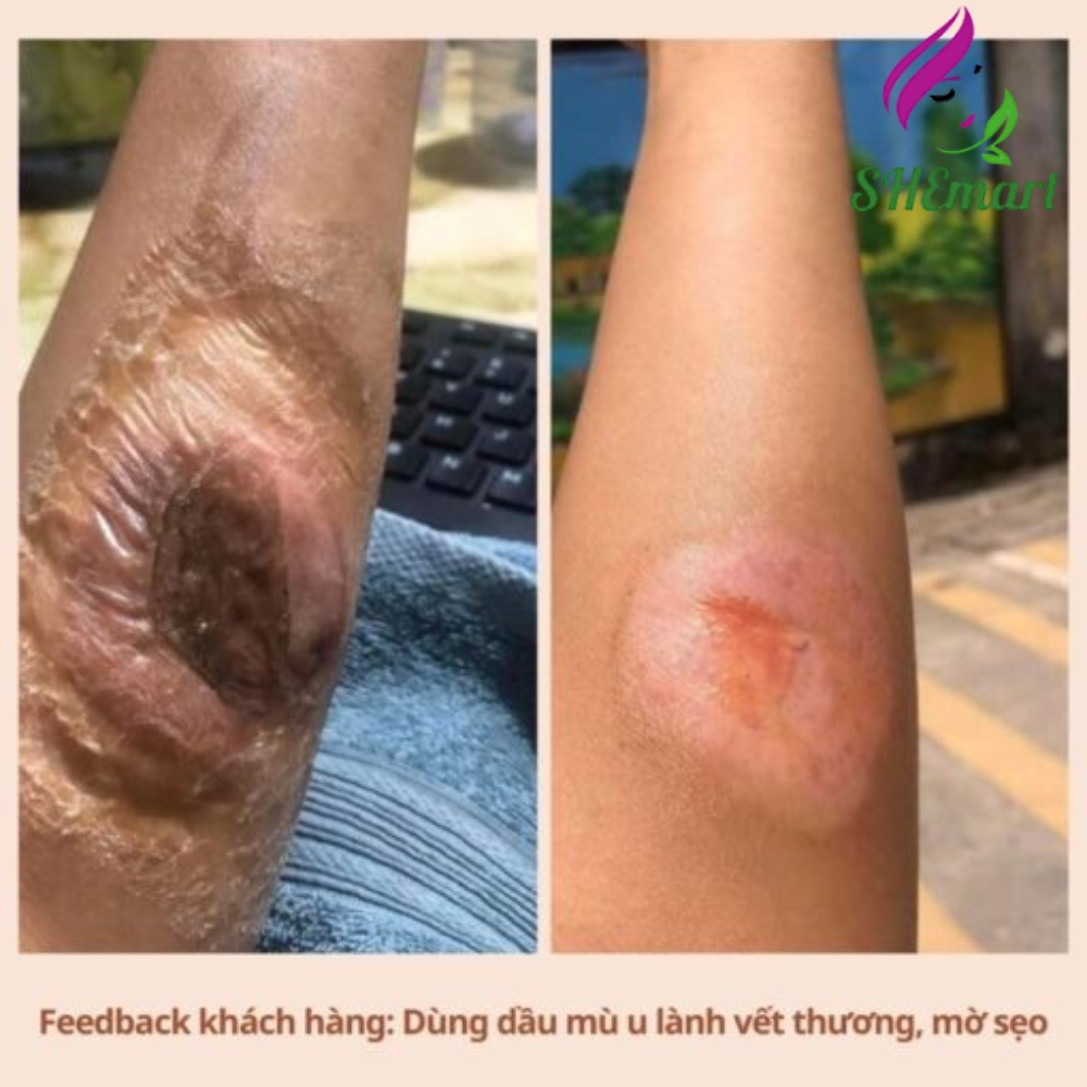 NOOM Cold-Pressed Tamanu Oil – A Natural Solution for Skin and Body Care